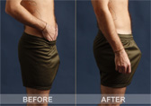 Joe Snyder Man-Up Bulge Booster Detail Photo Joe Snyder Man-Up Bulge Booster Detail 2